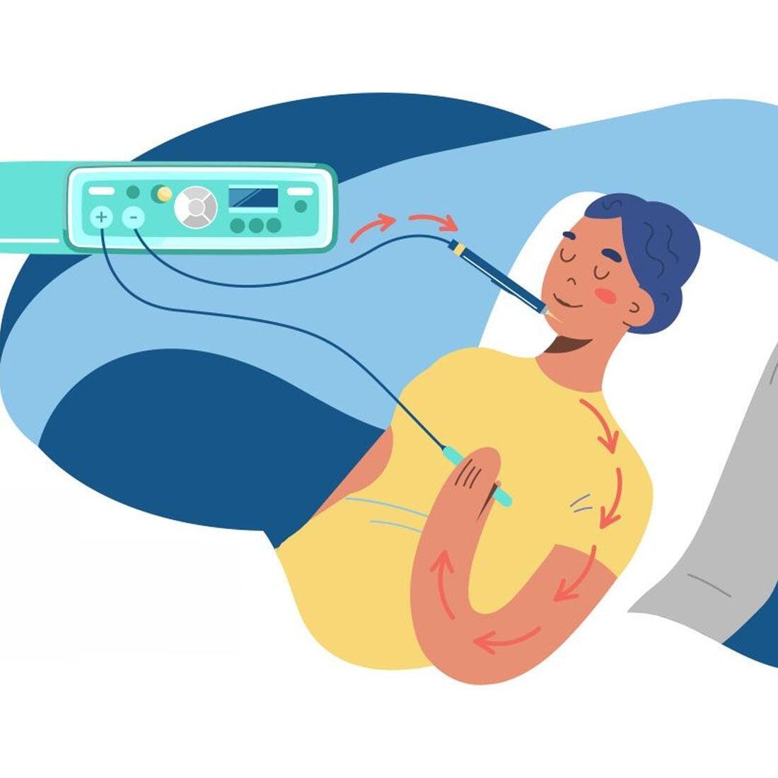 Galvanic Electrolysis